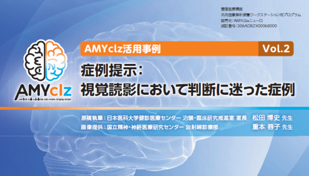 AMYclz活用事例Vol.2