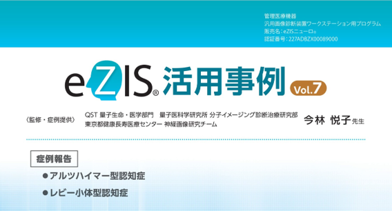 eZIS活用事例Vol.7(AD・DLB)　