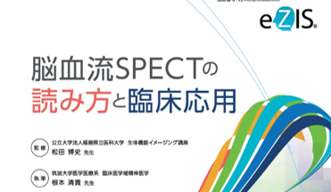 脳血流SPECTの読み方と臨床応用