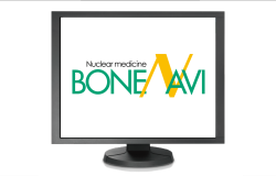 ボーンナビ<sub>®</sub>BSI
