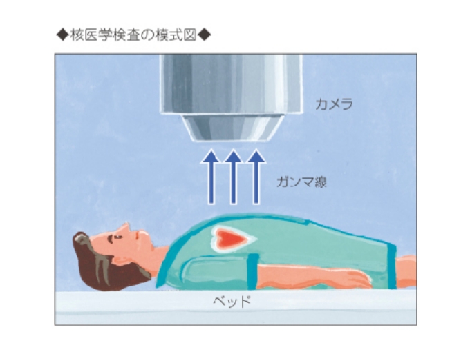 核医学検査の模式図